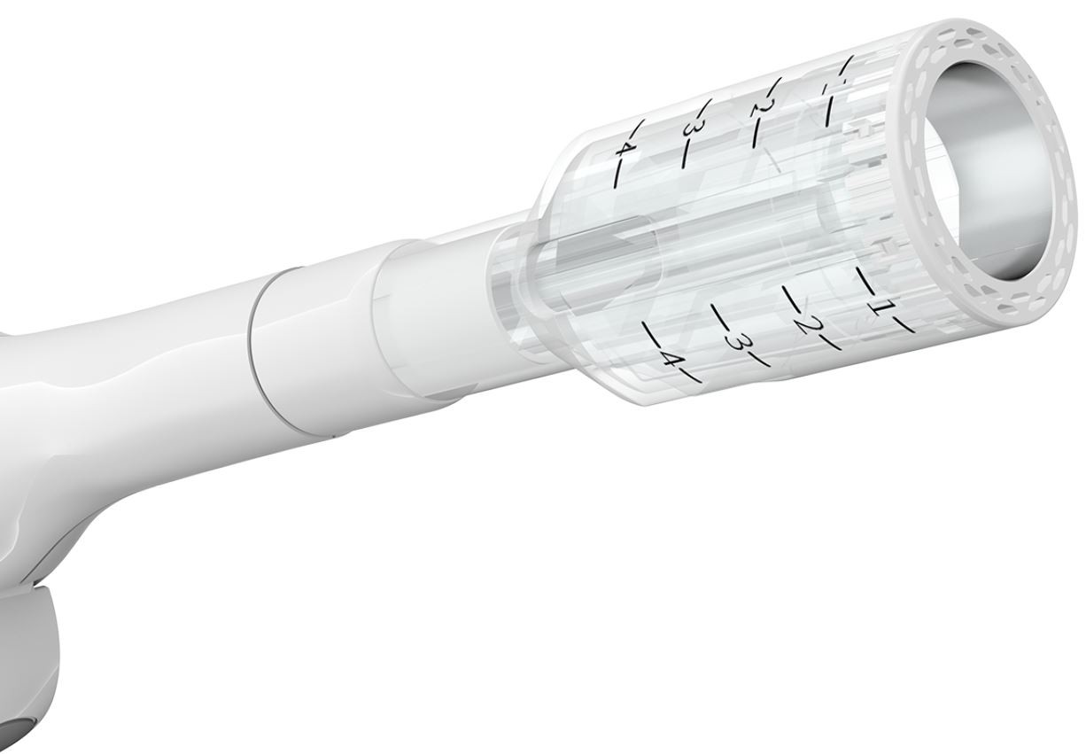 pph stapled hemorrhoidectomy.png