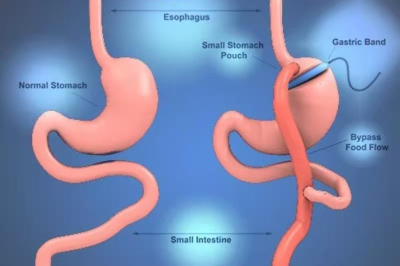 surgaid medical