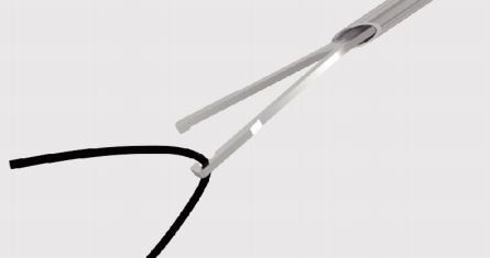 fascial closure system