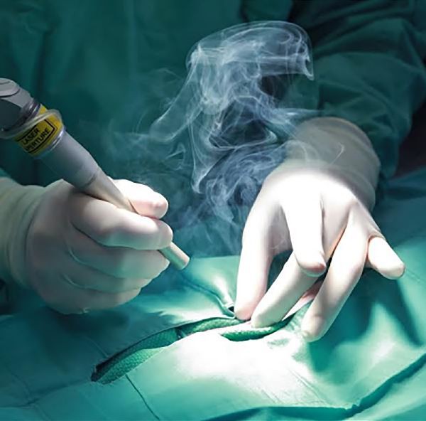 surgery smoke surgery smoke