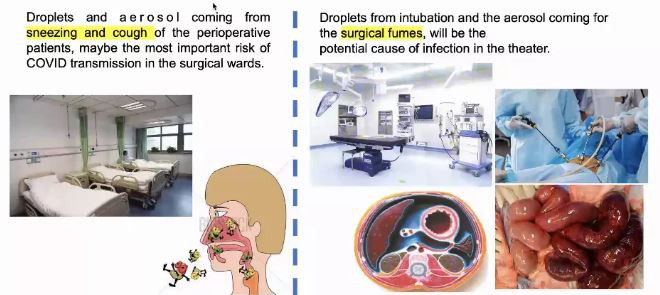 smoke surgery